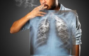 SMOKING AND LUNG CANCER