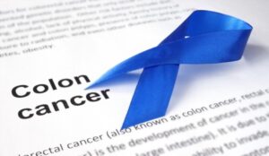 SIX WAYS TO PREVENT COLON CANCER