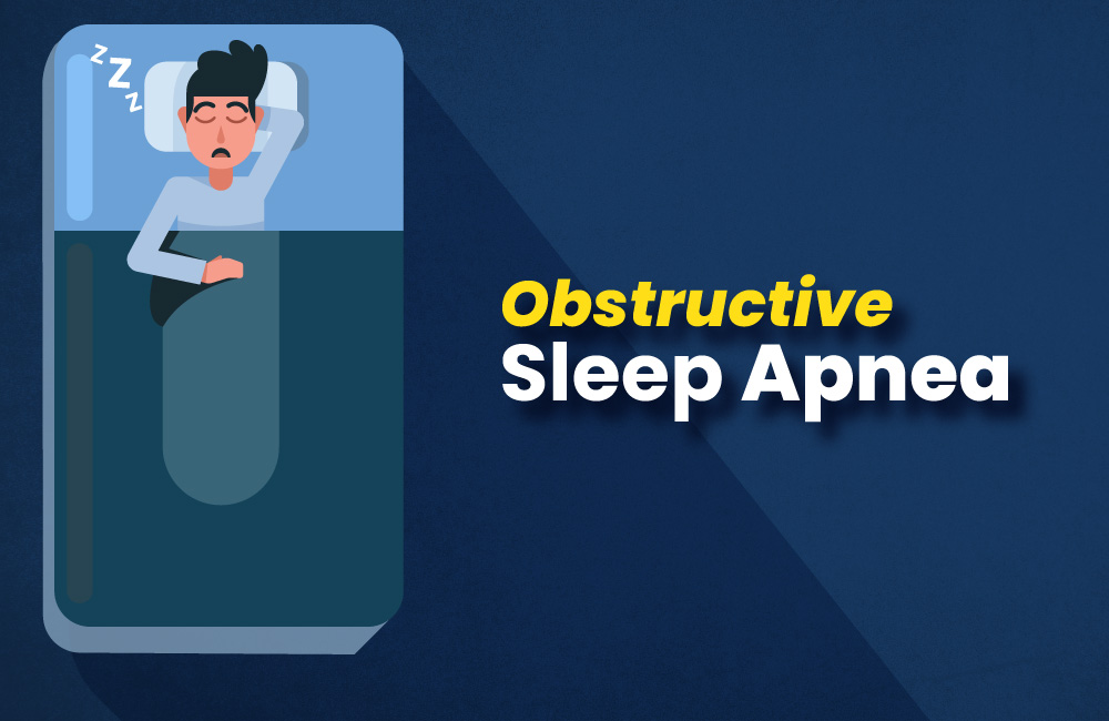 drkmh OBSTRUCTIVE SLEEP APNEA FAQ