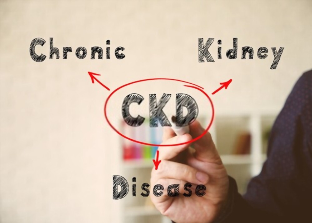 drkmh CHRONIC KIDNEY DISEASE – THE BASICS
