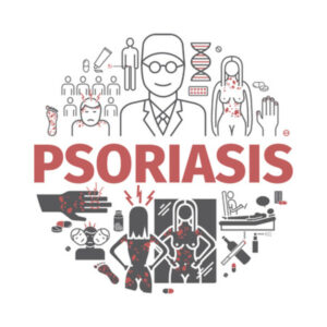 PSORIASIS: FAQs