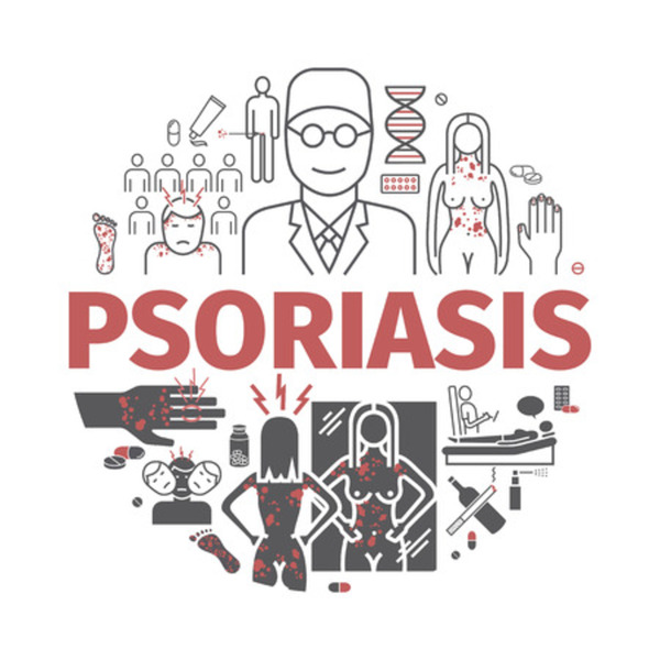 drkmh PSORIASIS: FAQs
