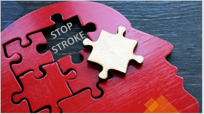 drkmh How to stop a stroke