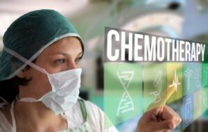 FAQ’s CHEMOTHERAPY
