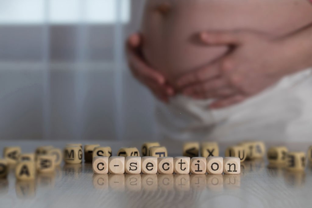 drkmh Myths and Facts about C- Sections