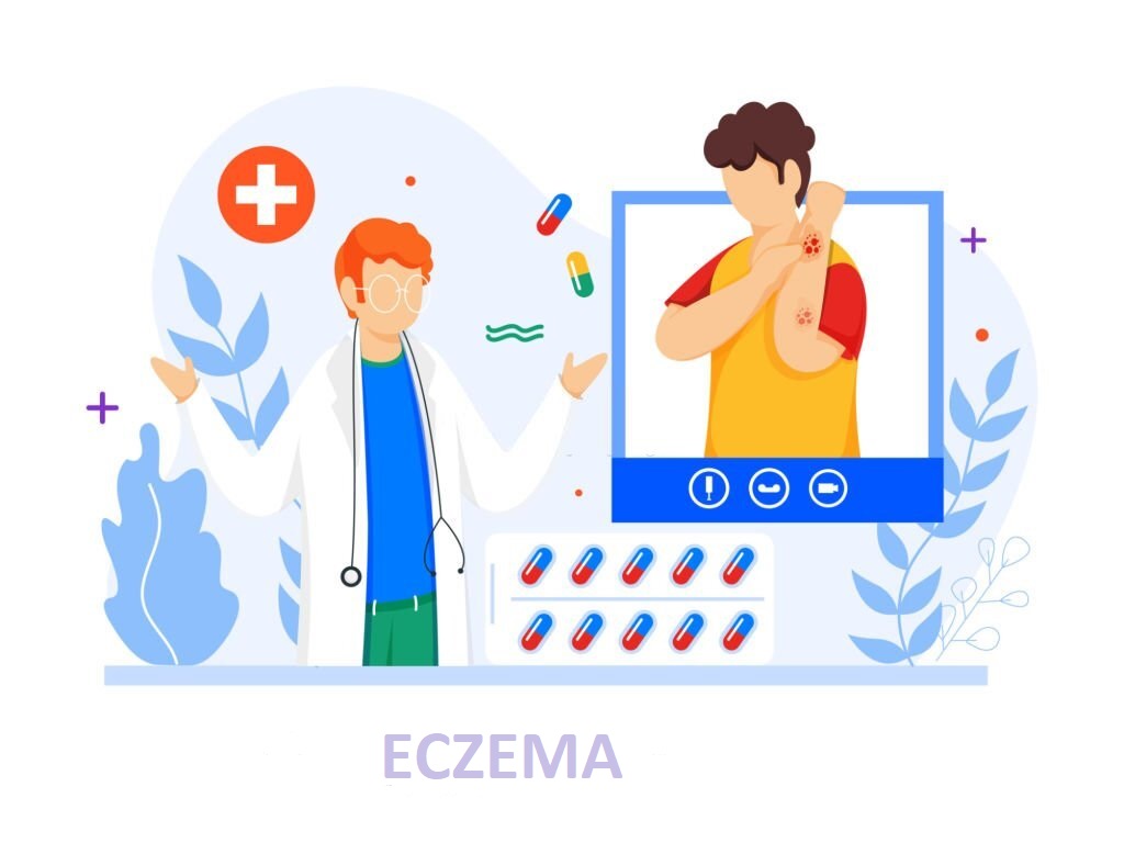 drkmh Treating, Managing and Living with Eczema