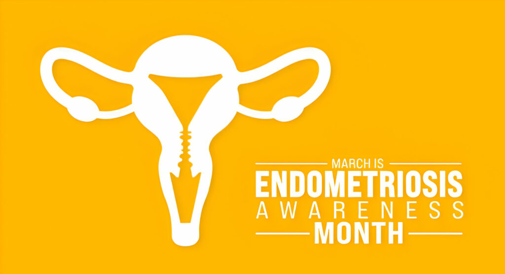 drkmh-endometriosis-faqs