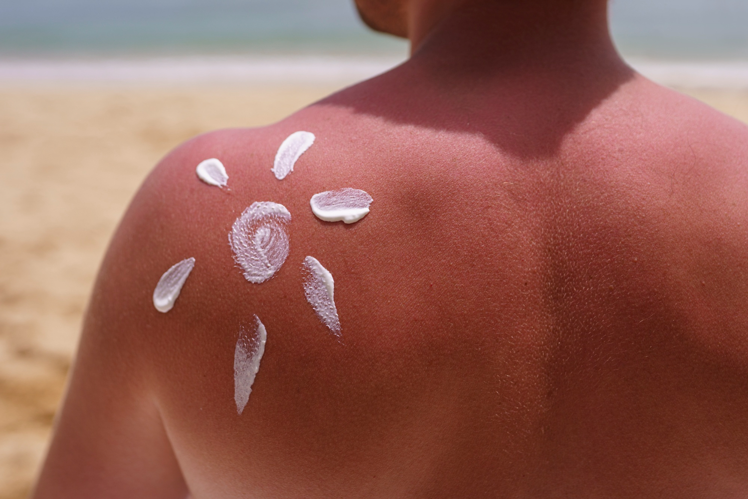 drkmh Beyond Sunburn: Long-Term Effects of UV Exposure on Skin and Eyes
