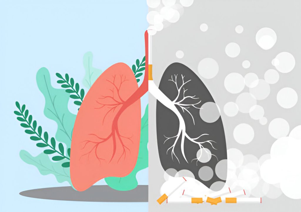 drkmh-Lung-Cancer-is-not-just-a-smokers-disease
