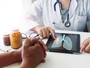 Pulmonary Rehabilitation, A Complete Guide to Better Breathing and Living