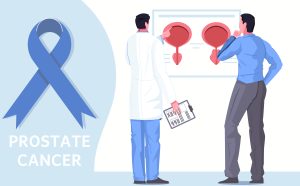 Myths and Facts About Prostate Cancer